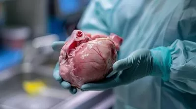 The Swine Solution? How Pig Kidneys Could Redefine Transplant Medicine