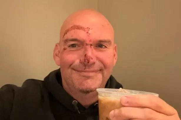 The Enduring Story Etched on a Face: Unraveling Fetterman's Scars