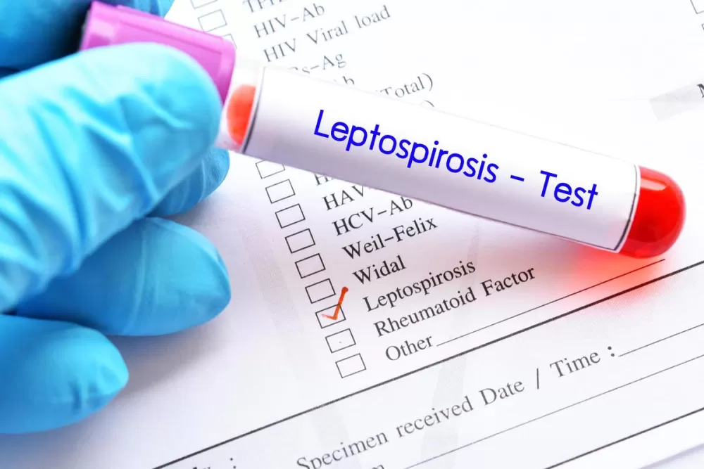 Leptospirosis: What the Monsoon Really Means for Your Health