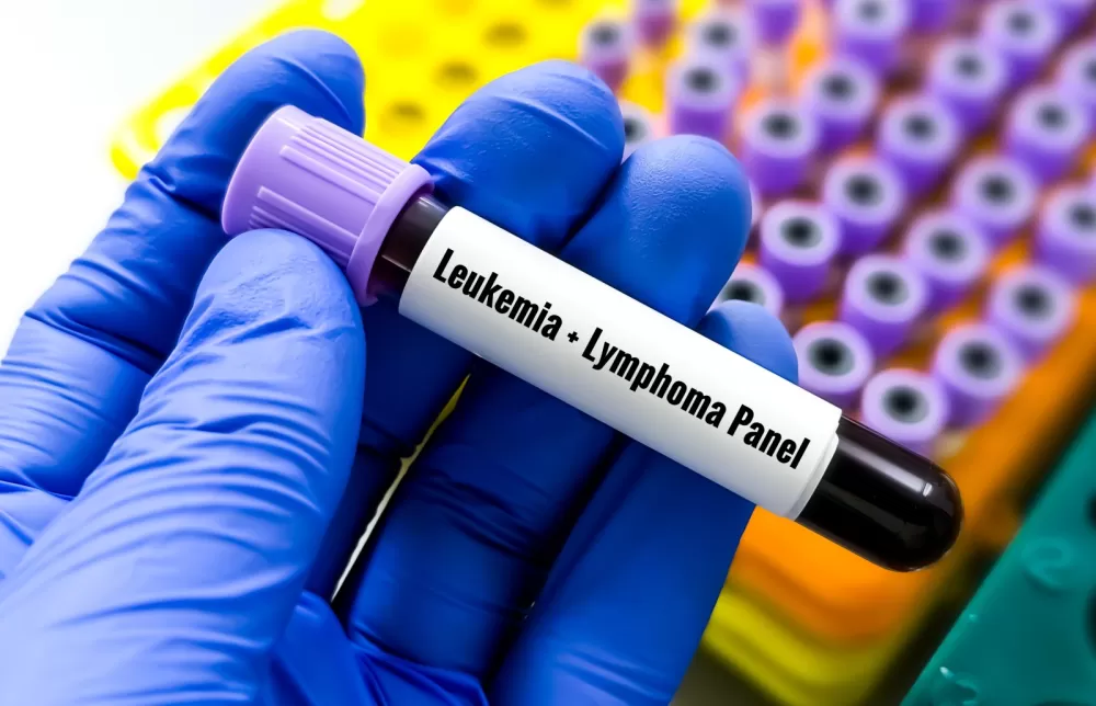 Vitamin C Shows Promise in Pre‑Leukemia Trial, but More Research Is Needed